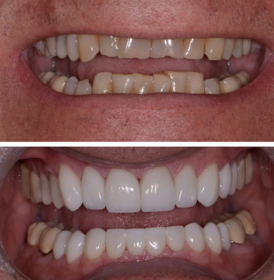 smile repair before and after